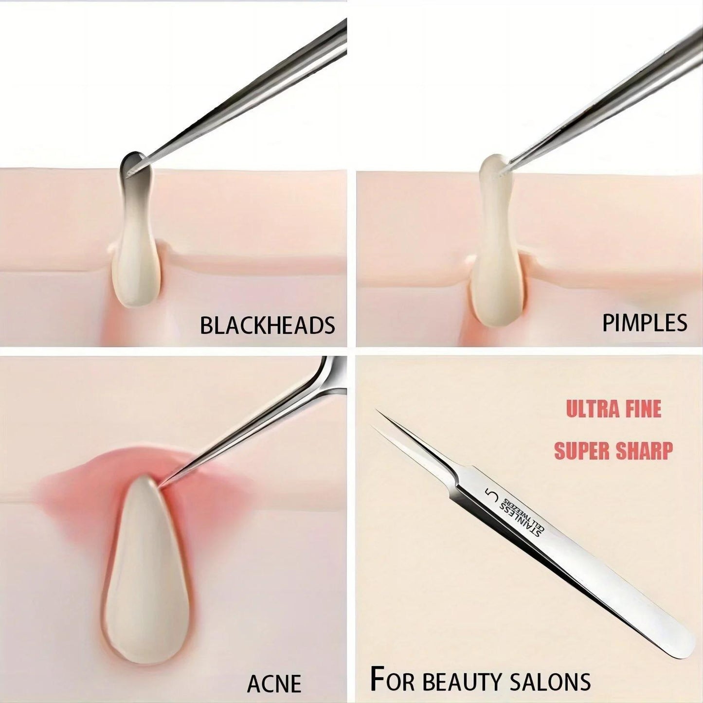 1pc Extra Fine No. 5 Cellular Blackhead Tweezers - Facial Beauty Needle Tools for Skin Care